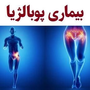 راه های جلوگیری از ابتلا به بیماری پوبالژیا