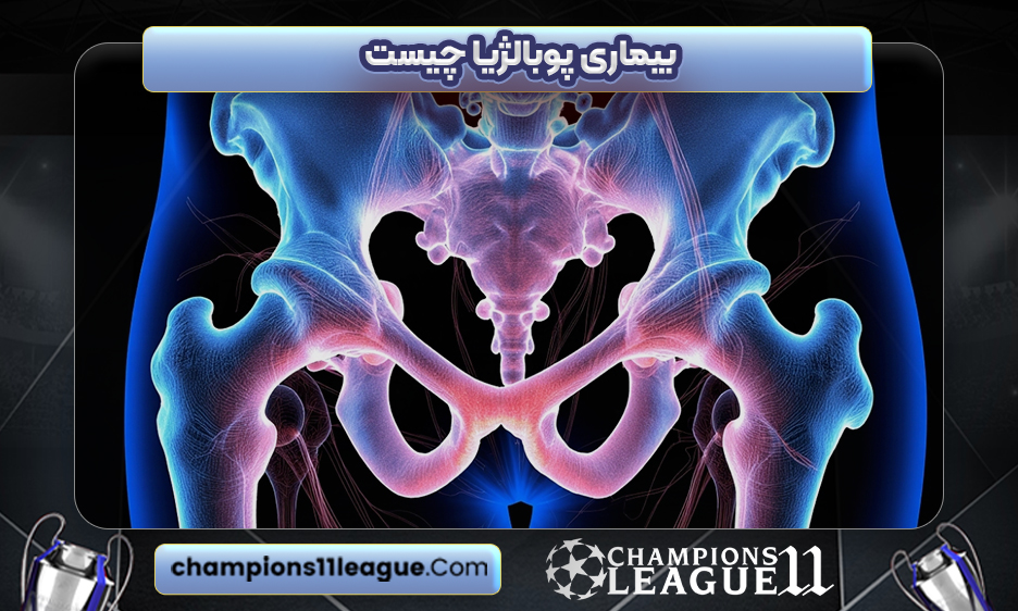 بیماری پوبالژیا چیست